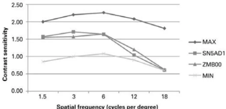 Figure 1. Preoperative long-distance visual acuity without (UDVA) correction, versus  post-operative UDVA versus postoperative visual acuity for long-distance with (CDVA)  correction for SN6AD1 and ZMB00 lenses.