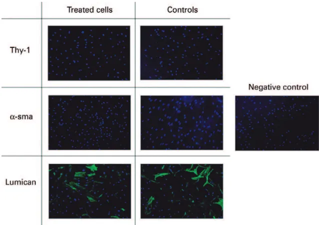 Figure 8. Immunoluorescence of cultured keratocytes submitted to crosslinking versus control cells not submitted to crosslinking (luorescence micros- micros-cope, 40×).