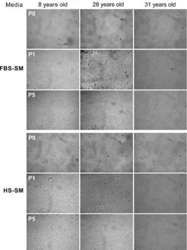 Figure 2. Phase-contrast images of conluent passage 0 (before cryopreservation) and  passages 1 and 5 (after cryopreservation) HCECs cultured in fetal bovine serum-su  pple-mented medium (FBS-SM) and human serum-supplepple-mented medium (HS-SM)