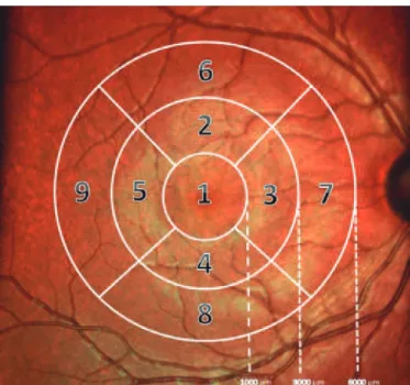 Figure 1. Segmented view of the retinal layers created using the Heidelberg Spectralis 