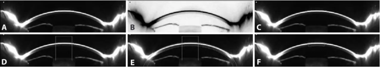 Figure 1. Image processing using Image J. A) An 8-bit image in which pixels with a value of zero are black and those with a value of 255 are white