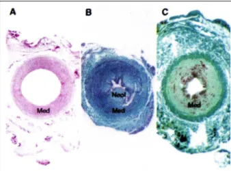 Fig. 1 - Fotomicrografias da artéria carótida comum de suíno, representativas: A) ar- ar-téria normal; B e C) intensa redução do lúmen arterial obtida quatro semanas após angioplastia experimental, causada por hiperplasia intimal (B) e por remodelamento ar