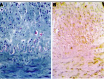 Fig. 2 - Fotomicrografias da artéria carótida comum de suíno, obtidas após angioplastia experimental