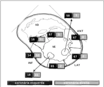 Fig. 3 - Perfusion bed size (arrows) in RCA dominance (A) and in the presence of a non-dominat RCA (B)