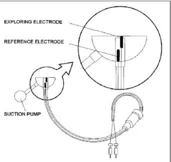 Fig. 4 - Sketch of the epicardial electrode for the MAP detection.
