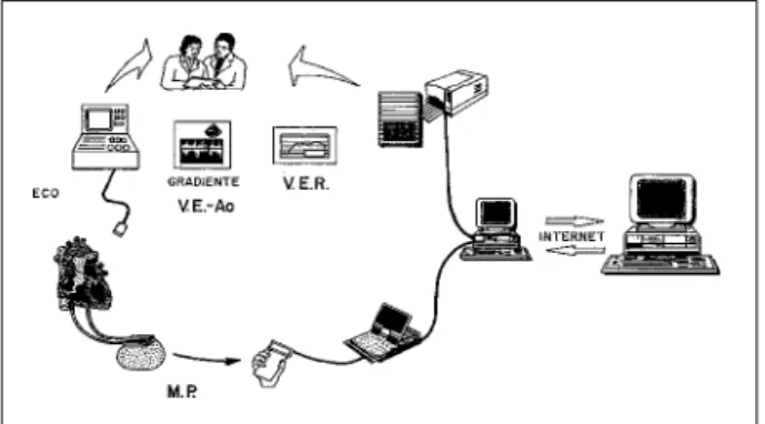 Fig. 1 - Procedures used during the study: Doppler echocardiography to record maximum left ventricular outflow tract gradient (LVOTG) and the acquisition, recording and analyzing intramyocardial electrogram, as ventricular evoked response (VER).
