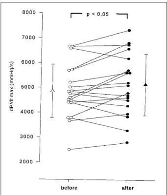 Fig. 2 – Individual values of the 1 st  temporal derivative of the ventricular pressure (dP/dt) before and after the elevation of the left ventricular end-diastolic pressure.