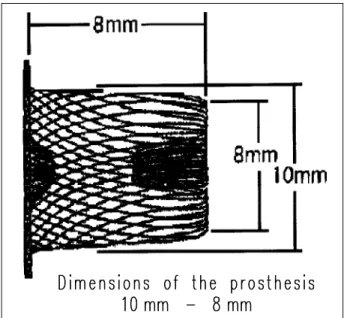 Table I - Dimensions of the prostheses and profile of the sheaths required for implantation