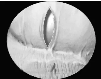 Fig. 3 - View of the heart after resection of the anterior part of the pericardium.