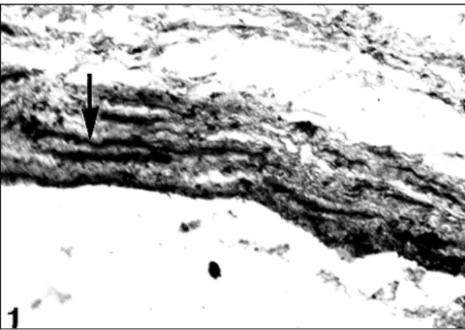 Fig. 1 – Cross-section at the level of the opening of the pulmonary vein in the left atrium