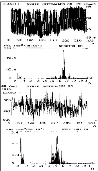 Fig. 2 – Record of the series of normal RR intervals and the respective power of a control individual of the same age group of the assessed patients