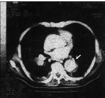 Fig. 3 – Eletrocardiograma.
