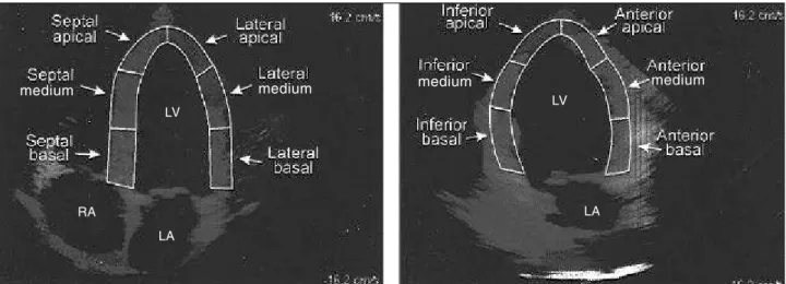 Fig. 1 – Left panel: a 4 –chamber view showing the segments assessed of the septal and lateral left ventricle (LV) wall