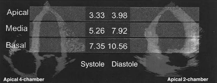 Fig. 4 – Mean of systolic and diastolic peak velocities by region (basal, medial, and apical).