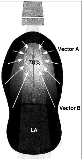 Fig. 5 – The resulting vector of the myocardial movement is directed by a point inside the ventricle at approximately 70% of its longitudinal diameter