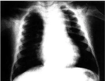 Fig. 1 – Chest X-rays.