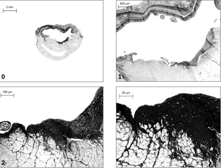 Fig. 2 - Picrosirius red-stained sections of a coronal heart tissue section from rat with a large myocardial infarction
