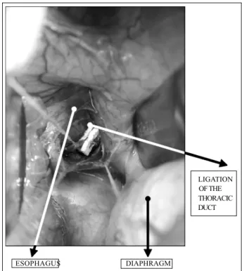 Fig. 1 – Ligation of the thoracic duct.