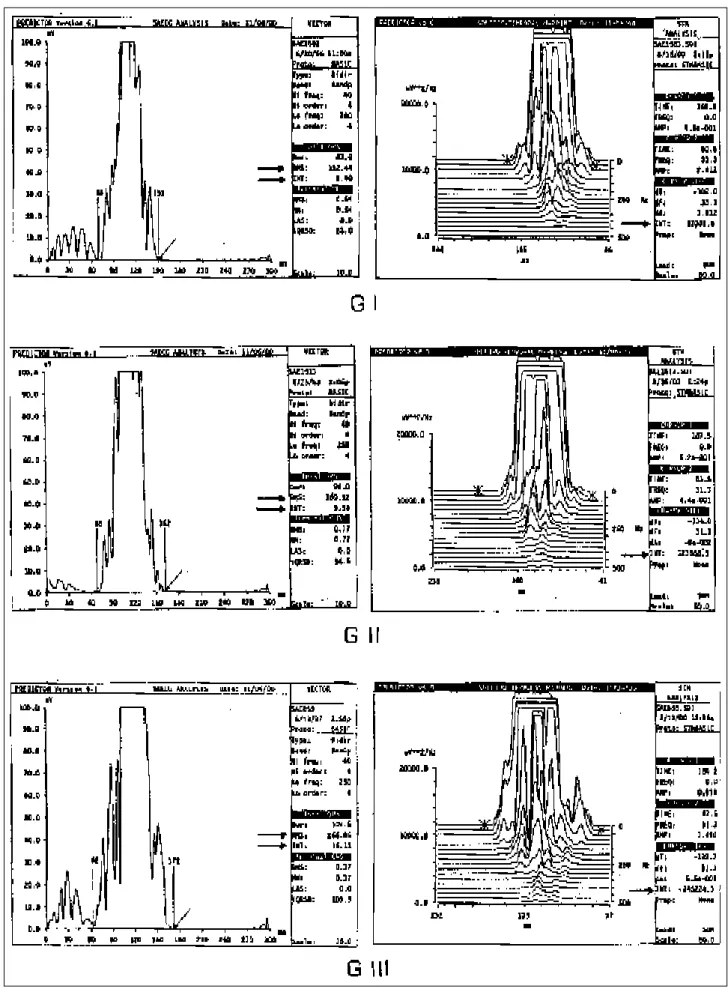 Fig. 1 - Examples of magnitude vectors in each group studied. Note that all variables in the time (left) and frequency (right) domains are increased (arrows) from GI to GIII, indicating an increase in the electrical signal energy between GII and GI and bet