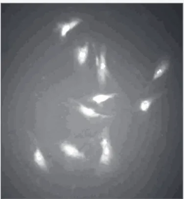 Fig. 1 - Cell cocultivation showing the presence of cells of muscular origin. (Anti- (Anti-desmin, immunofluorescence, 40x).