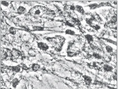 Fig. 2 - Cell cocultivation showing the presence of cells of mesenchymal origin.