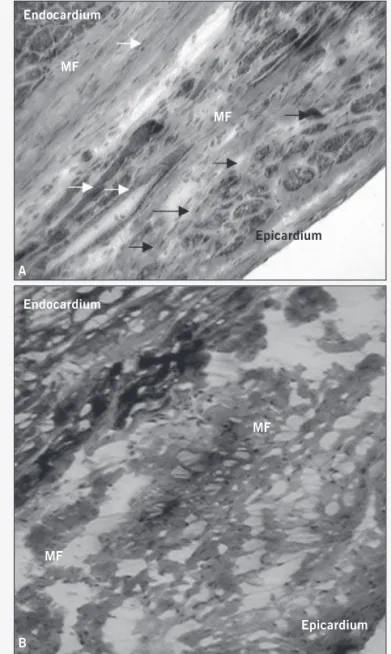 Fig. 5 – End sistolic volume of left ventricle between the groups and in the two periods evaluation.