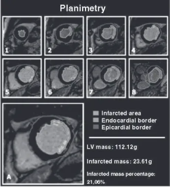 Fig. 3 - Images of the patient of figure 2, showing the application of the scoring method