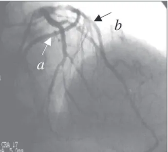 Fig. 1 - Electrocardiogram at rest.