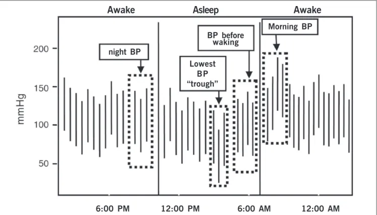 Fig. 2 - Parameters used for calculation of morning surge in blood pressure. 21