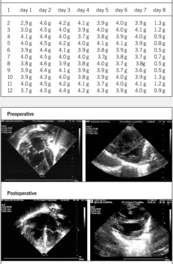 Table II - Daily evolution of ventricular mass gain after the first stage