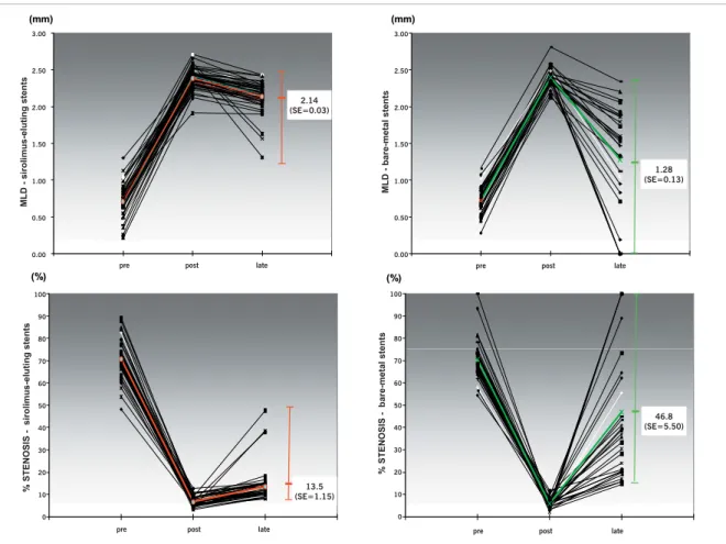 Fig. 1 - Angiographic measurement variations (MLD above and stenosis rate below) preprocedural, postprocedural, and at eight months in both treatment  groups (sirolimus-eluting stents on the left and bare-metal stents on the right)