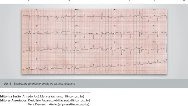 Fig. 1 - Sobrecarga ventricular direita no eletrocardiograma