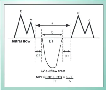 Fig. 1 - Schematic representation of the time intervals at Doppler for the  calculation of the Myocardial Performance Index (MPI) or Tei Index