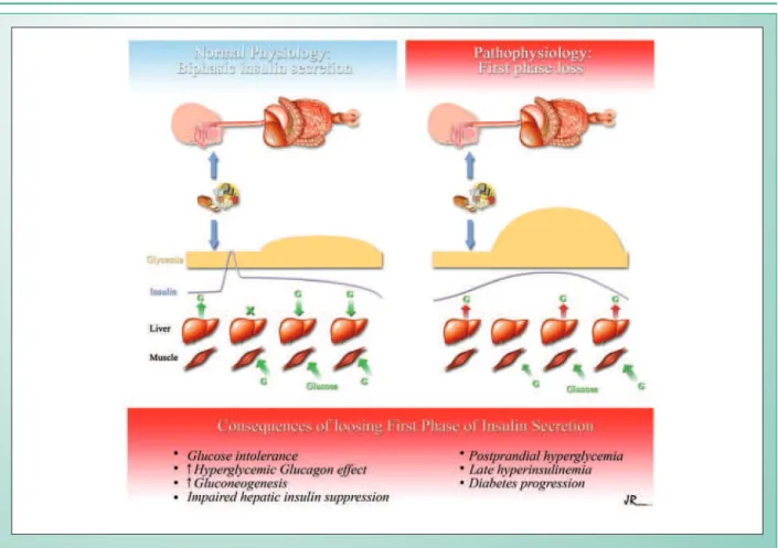 Fig. 1 - Effects of first phase failure: Sustained hepatic glucose output, reduced peripheral glucose uptake, resulting in postprandial hyperglycemic.