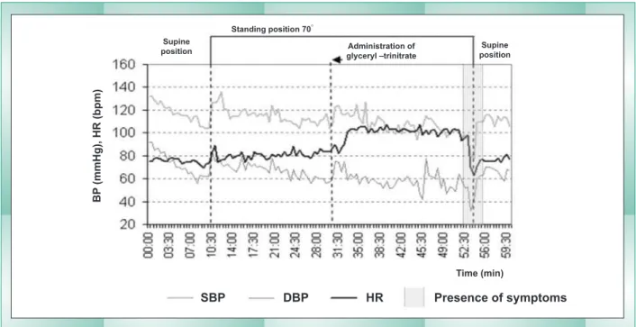 Fig. 1 - Patient�s tilt table test. SBP � systolic blood pressure; DBP � diastolic blood pressure; HR � heart rate
