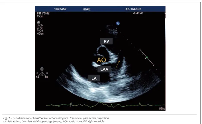 Fig. 2A - Real-time three-dimensional transthoracic echocardiogram. Longitudinal parasternal projection