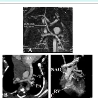 Table 2 - Extracorporeal circulation