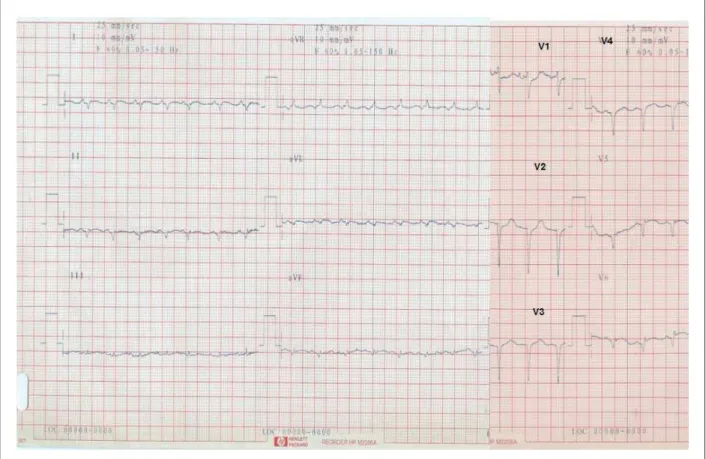 Tabela 1 – Dados hemodinâmicos obtidos  com o cateter de Swan-Ganz