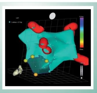 Fig. 1 - Reconstruction of the Left Atrial Chamber