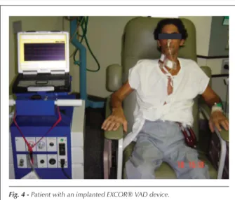 Fig. 4 - Patient with an implanted EXCOR® VAD device.