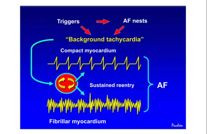 Fig. 7 - Schematic representation showing the behavior of fibrillar and compact myocardia activated by background tachycardia, which behaves as a protected microreentry  with high frequency, induced by the triggers