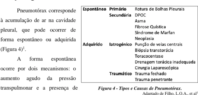 Figura 4 - Tipos e Causas de Pneumotórax.  