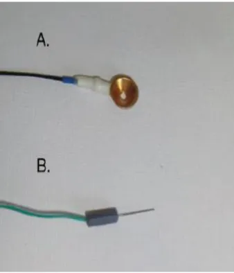 Figura 3 - Elétrodos de superfície de  prata, fixados com colódio para a  realização do EEG (caso clínico)