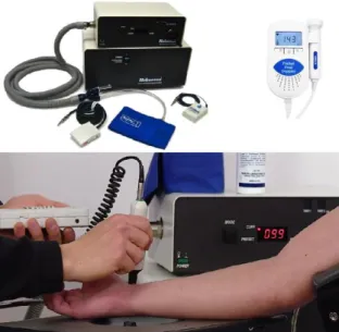 Figure  2.  Graphic  representation  of  absolute  occlusion  pressure  determination  (down)  and  instrumentation, 