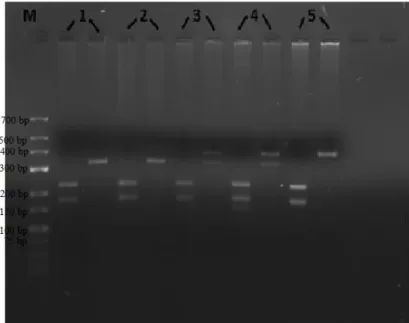 Figura 8 - Electroforese em gel de agarose a 3% de fragmentos de PCR-RFLP da ACP1. M -  Marcador, canal 1 – BB, canal 2, 3 e 4- AB; canal 5 - AA