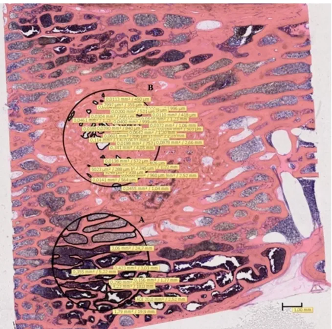 Figure 1. Histomorphometric study. Giemsa staining, 0.55x magnification; the circles are limiting the two areas  of interest: A) newly formed trabecular bone within the defect; B) mature trabecular bone outside the defect