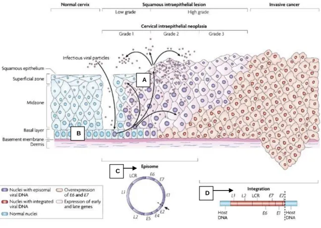 Figura  2.  Representação  esquemática  da  infeção  do  colo  do  útero  pelo  HPV  (adaptado  de  Woodman, 2007) [41]