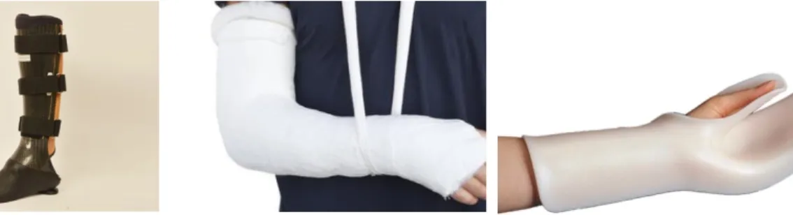Figure  11:  Traditional  Prosthesis  of  Inferior Limb 