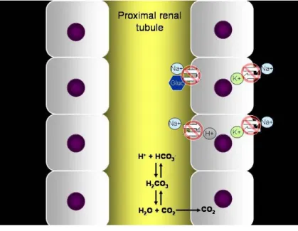 Figura nº 3: Ilustração da teoria de falha no mecanismo  de geração do gradiente de concentração de sódio por  deficiência na função das bombas de Na + /K + -ATPase na 