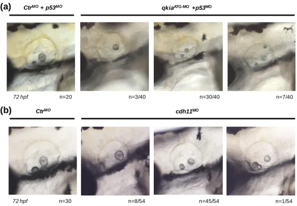Fig. II.4 – qkia knockdown and cdh11 knockdown affect otolith formation. 